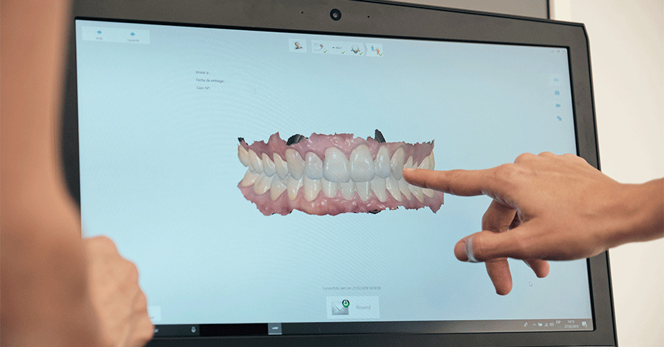 A imagem mostra parte do rosto de uma mulher loira, que está em um consultório odontológico. Ela segura um aparelho invisível entre seus dedos, e está prestes a encaixá-lo na arcada dentária.