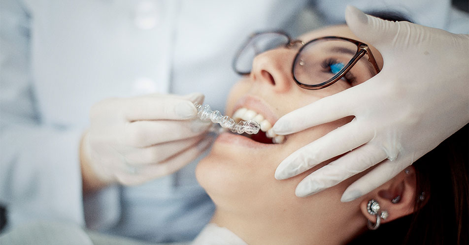 Há uma mulher deitada em uma cadeira de dentista. Ela usa um óculos com uma armação escura e brincos nas orelhas. Ao seu lado, aparecem as mãos de uma dentista com luvas cirúrgicas segurando um alinhador Invisalign®, pronto para ser aplicado aos dentes da paciente. A dentista usa uma jaleco azul claro.