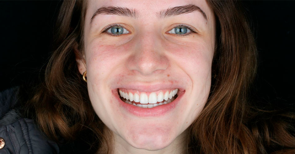 Imagem da paciente Cris sorrindo